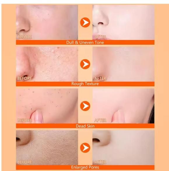 Exfoliating Kojic Acid Turmeric Spray 400 ml Pack of 2